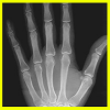 Xray App by Rosario Android