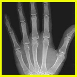 Xray App by Rosario Android